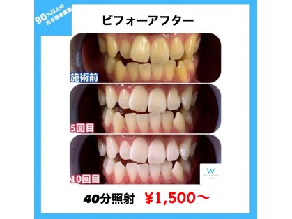 ホワイトニングショップ 長岡京店の写真