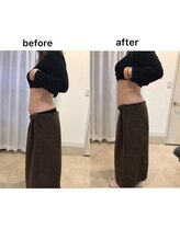 ジョワイユ(Joyeux)/腸の位置でお腹は変わる