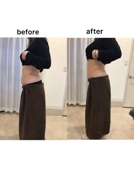 ジョワイユ(Joyeux)/腸の位置でお腹は変わる