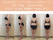 エターナルフレーム(Eternal Flame)/41歳全身痩身スリム20回術前術後