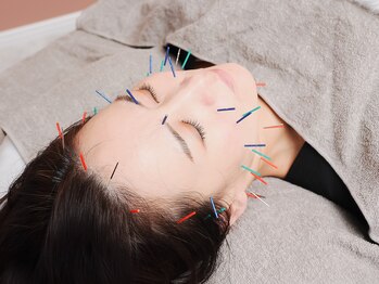 ハリサク/美容鍼