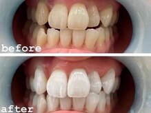 ボディケアアップ(BODY CARE UP↑)/清潔感ある口元に