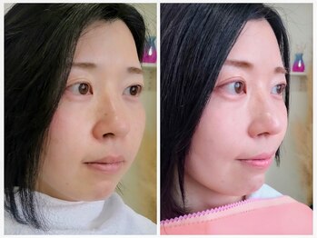 エタニティ(Eternity)/メイクlesson