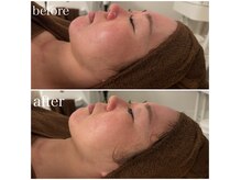 23ビューティー(23beauty)の雰囲気（リフトアップ・小顔もお任せください♪）