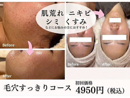 ビューティーリアライズ(Beauty Realize)の写真