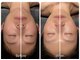 アイセ(AISE)の写真