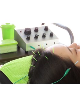 鍼灸施術を受けたい