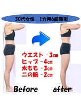 フェリス.ディア(Feliz.Dia)/【ビフォーアフター3】