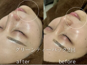 グランクウォーレ(Gran Cuore)/くすみに★