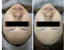 ラン(Ran)/コルギAfter写真