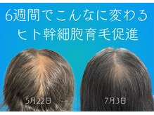 癒真天神の雰囲気（毛髪の悩みをRe:genexellで今すぐ解決しませんか？）