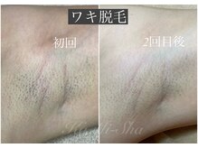 カミーシャ(KaMi-Sha)/お手入れ忘れた！はもうおしまい