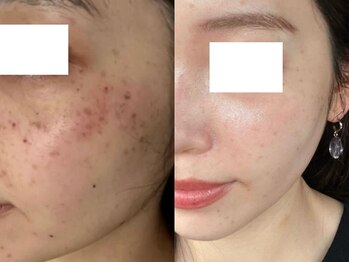 エイチケービューティーサロン(H/K beauty salon)