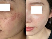 エイチケービューティーサロン(H/K beauty salon)