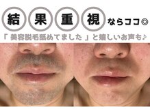 小春日和の雰囲気（大人気のヒゲ脱毛！部分脱毛も大歓迎♪）