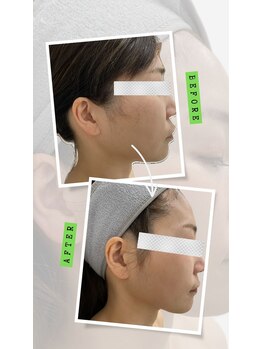 グリンダ キタイ(glinda kitai)/もたつきサヨウナラ