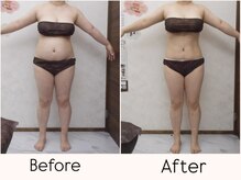 エステティックサロン ルテラ