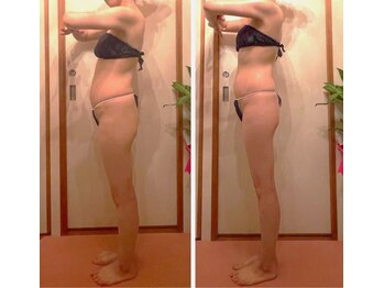 ティアラ/ぽっこりお腹もスッキリ解消♪