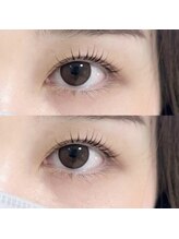 abp /ラッシュリフト