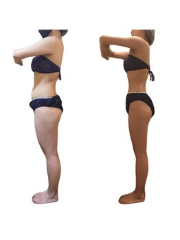 ナリジム 赤坂/4カ月-14kg(身長158cm47キロ