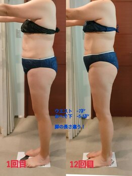 ビューティーエッセンス 都立大学(BEAUTY ESSENCE)/美骨盤&インディバ