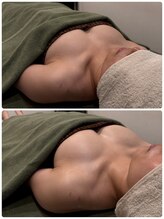 ビープラス(B+)/before＆after