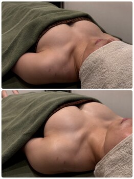 ビープラス(B+)/before＆after