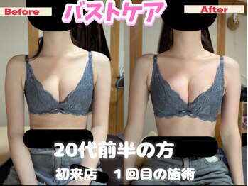 スノードロップ(snowdrop)/