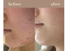 ユーアンドハニー(U&Honey.)/誰もが羨むウルつや美肌！