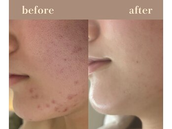 ユーアンドハニー(U&Honey.)/誰もが羨むウルつや美肌！