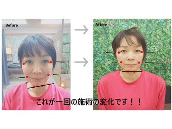 眼のチカラ 本町店/小顔矯正