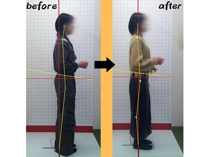 ほねつぎ 荒川沖はりきゅう接骨院の写真