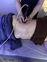 ラフィネ(Raffine)/ラジオ波