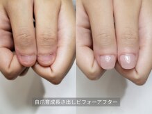 ミンスネイル(Mins Nail)/
