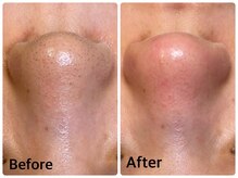 クロス(Xcross)の雰囲気（《ハーブピーリング》フェイシャル・ボディのハーブピーリング◎）