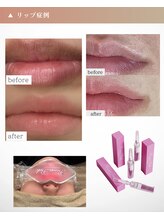 リシェリ 代官山(RICHERI)/ローマピンク施術部位追加で割引