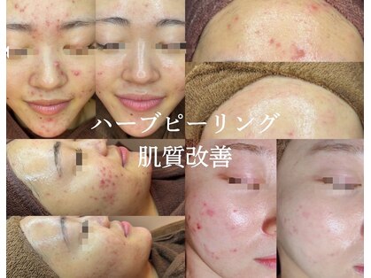 インディビューティー 六本木店(inde beauty)の写真