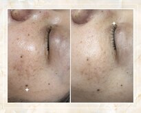 サロンルナ(Salon Luna)