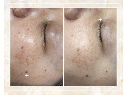 サロンルナ(Salon Luna)の写真