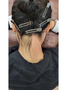 セリシエル(cericiel)/うなじ脱毛