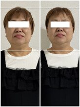 アンドブレインビューティー(and.Brain Beauty)/ヘッドスパスペシャルコース