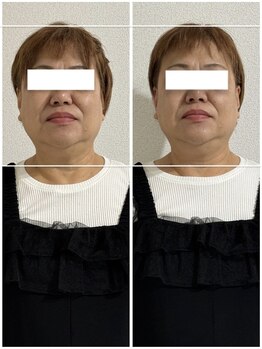 アンドブレインビューティー(and.Brain Beauty)/ヘッドスパスペシャルコース