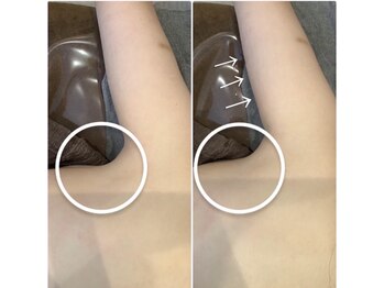 ブローチ 岡崎店(BROOCH)/はみ肉バイバイ!すっきり二の腕