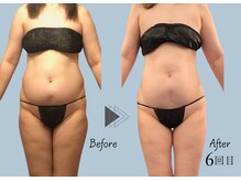 スクエア サロン(Square Salon)/通うほど実感の変化◎