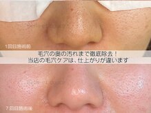 ベルエドゥース(Belle et Douce)の雰囲気(当店の毛穴ケアは仕上がりが違います!)