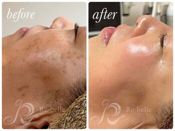 チップ(chip)/ここまで変わる