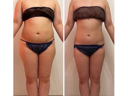 ピエルポゼ(Piereposer)の写真