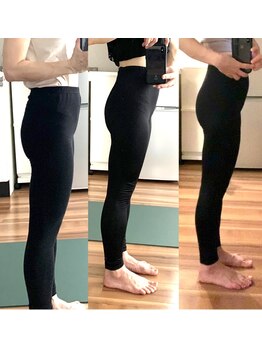 ビューティーパンク 黒田鍼治療院(Beauty Punc)の写真/そのストレッチ貴方にあっていますか？続けているストレッチやマッサージも変化がなっくなってきたら替え時