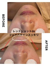 ジーンバイピエル 中野店(gene by PIEL)