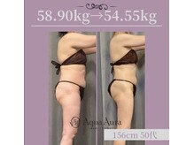 ボディエステティック アクアオーラ 富山店/最初の一歩を踏み出す勇気